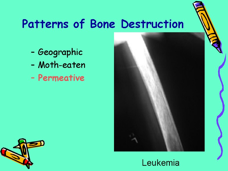 Patterns of Bone Destruction Geographic Moth-eaten Permeative Leukemia